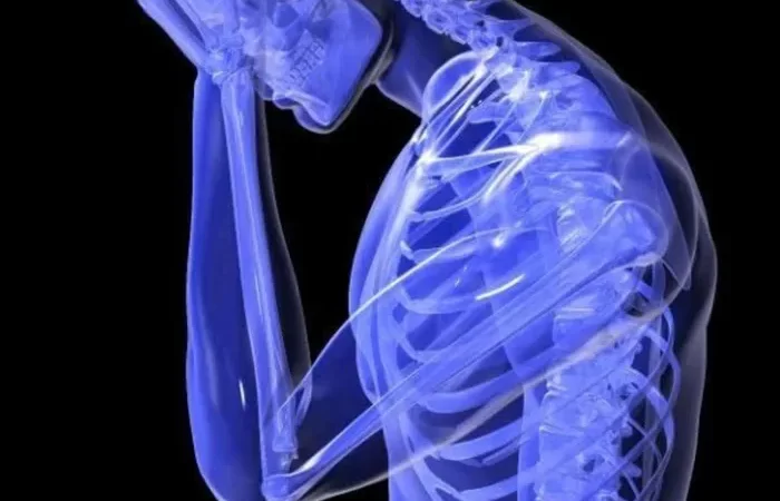 Top 99+ hình ảnh meme đau đầu khiến bạn cười thả ga